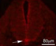 PAB8520 - Autotaxin / ENPP2