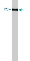 PAB8521 - Autotaxin / ENPP2