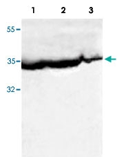 PAB8528 - Bcl-2-like 5