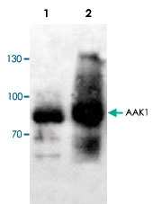 PAB8529 - AAK1