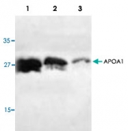 PAB8546 - Apolipoprotein A I / APO AI