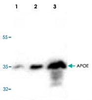 PAB8547 - Apolipoprotein E / Apo E