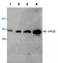 PAB8548 - Apolipoprotein E / Apo E