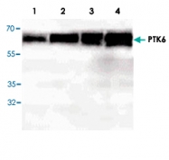 PAB8599 - PTK6 / BRK