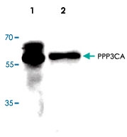 PAB8605 - PPP3CA / Calcineurin A