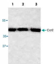 PAB8642 - CD192 / CCR2