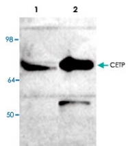 PAB8647 - CETP