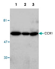 PAB8648 - CFLAR / Casper / I-FLICE