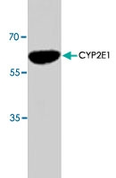 PAB8667 - CYP2E1