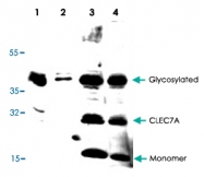 PAB8670 - CLEC7A / Dectin-1
