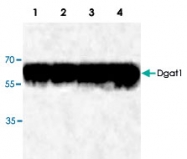 PAB8674 - DGAT1
