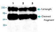 PAB8675 - DICER1