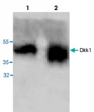 PAB8677 - Dickkopf-1
