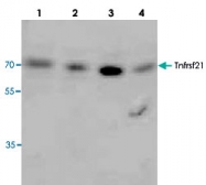 PAB8690 - TNFRSF21 / Death receptor 6 (DR6)