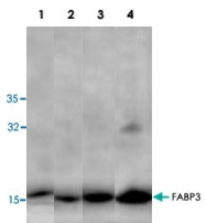 PAB8704 - FABP3