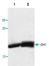 PAB8741 - Somatotropin / Growth Hormone / GH1