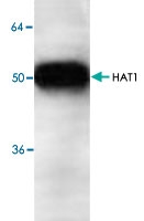 PAB8744 - HAT1