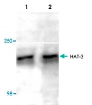 PAB8745 - MYST3