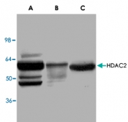 PAB8750 - HDAC2