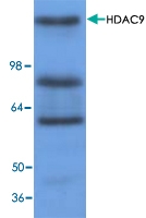 PAB8755 - HDAC9