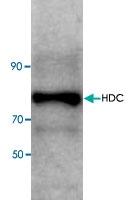 PAB8756 - Histidine decarboxylase