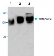 PAB8772 - Heat shock factor 1 / HSF1