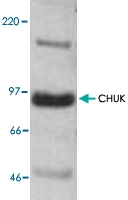 PAB8780 - IKKA