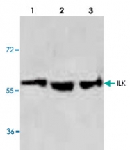 PAB8785 - Integrin-linked protein kinase