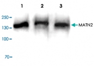 PAB8820 - Matrilin-2