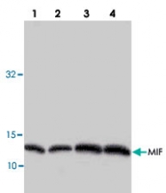 PAB8836 - MIF