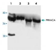PAB8919 - PRKACA