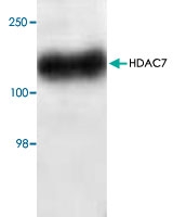 PAB8928 - HDAC7