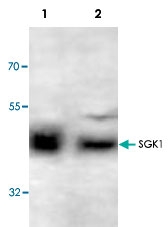 PAB9020 - SGK1 / SGK