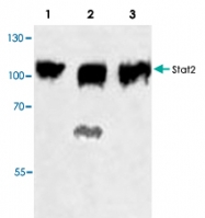 PAB9038 - STAT2