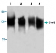 PAB9039 - STAT3