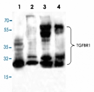 PAB9055 - TGFBR1 / ALK-5