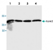 PAB9063 - KCNK2
