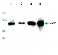 PAB9068 - VASP
