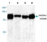 PAB9092 - HADHA