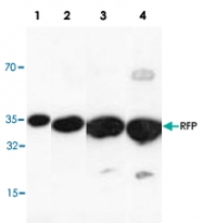 PAB9104 - RFP-Tag