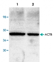 PAB9123 - Actin beta / ACTB