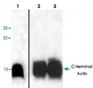 PAB9124 - Actin beta / ACTB