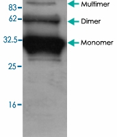 PAB9125 - Adiponectin