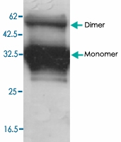 PAB9129 - Adiponectin