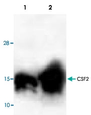 PAB9494 - GM-CSF