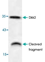 PAB9511 - Dickkopf-2 (DKK2)