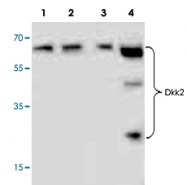 PAB9512 - Dickkopf-2 (DKK2)