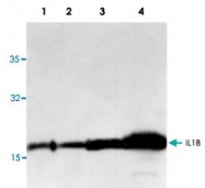 PAB9534 - Interleukin-1 beta / IL-1B
