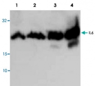 PAB9536 - Interleukin-6 / IL6