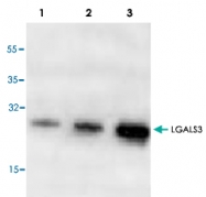 PAB9547 - Galectin-3
